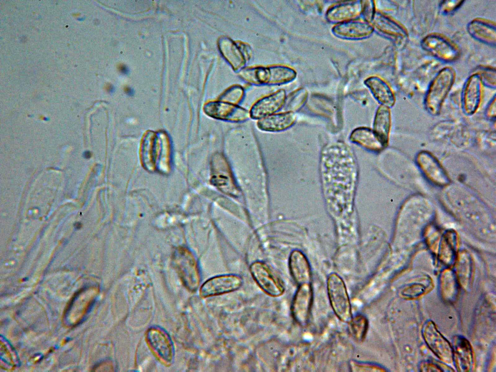 Microscopía de Ramaria suecica - 10 - Basidio tetrasporico amoníaco